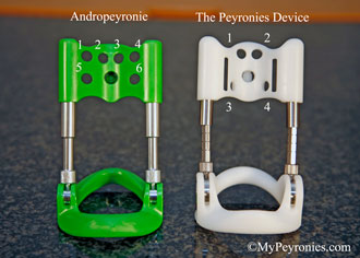 Andropeyronie compared with the Peyronies Device