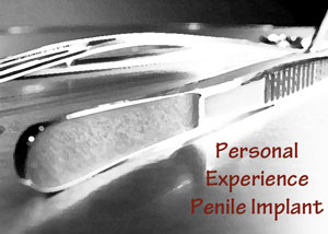 Personal experienc of penile implants